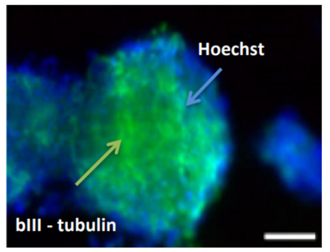 Enlarged view of a Neuronal stem cell